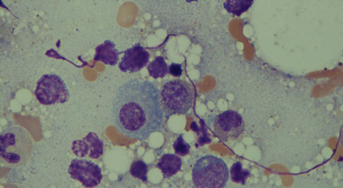 Image of myeloma cell