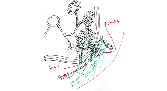 Sketch drawing of prostate