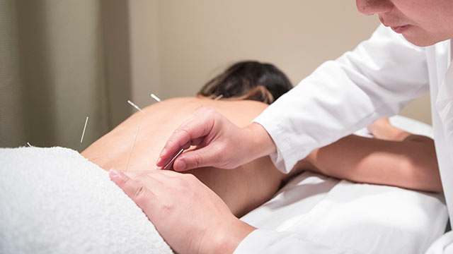 image of acupuncture being preformed