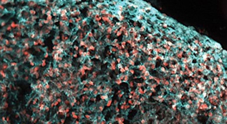 Dementia image