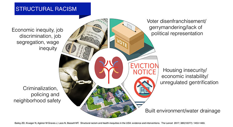 structural racism