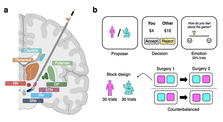 illustration of brain