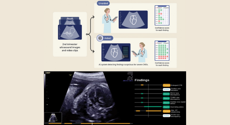 AI Tool Fetal Screening