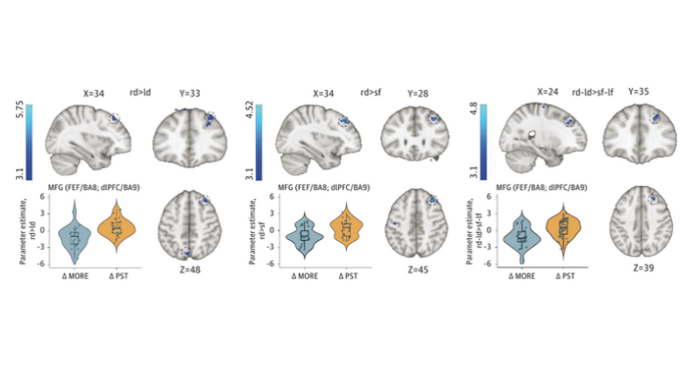 Brain Opioid Responses