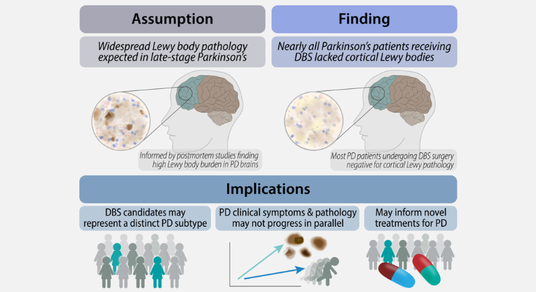 Pathology Parkinson's
