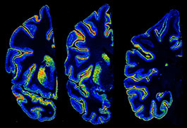 Psychiatry