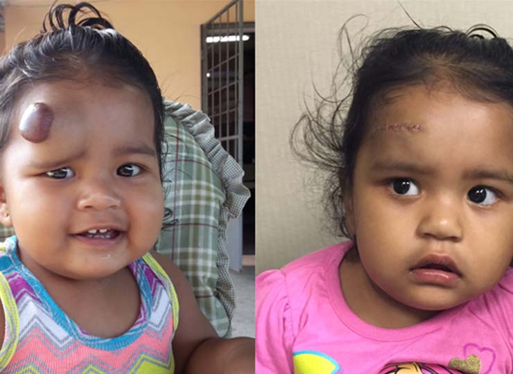 Photo of Before and After surgery