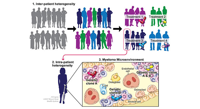 Research Multiple Myeloma