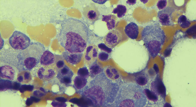 Image of myeloma cell