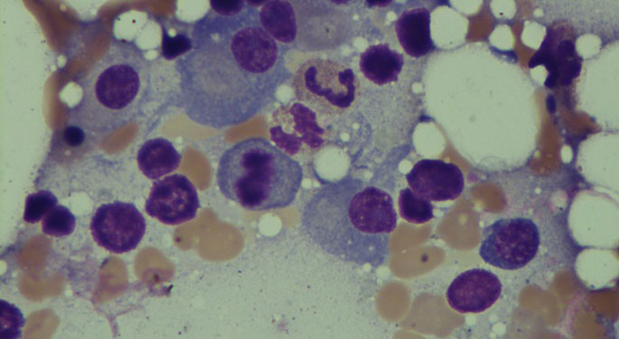 Image of myeloma cell