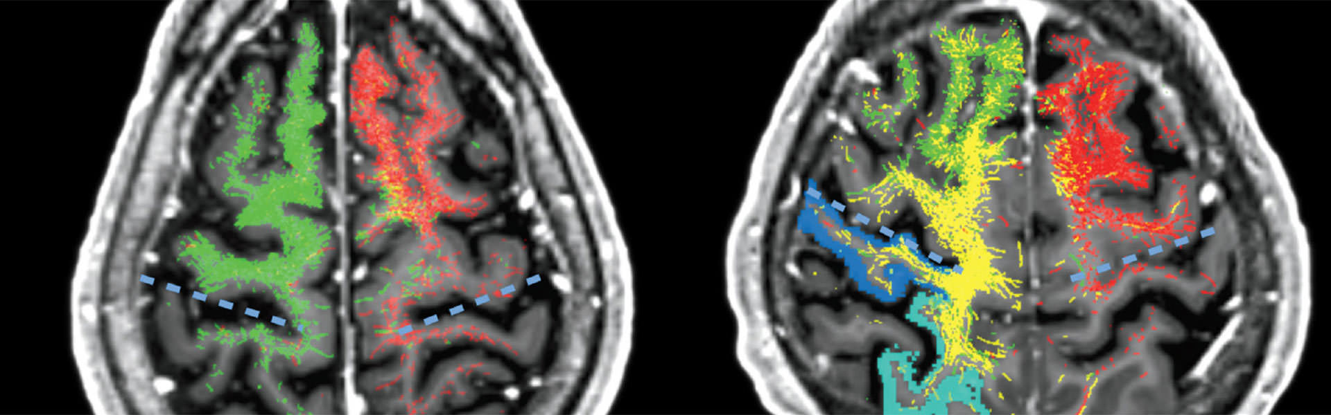 Neurology Specialty Report