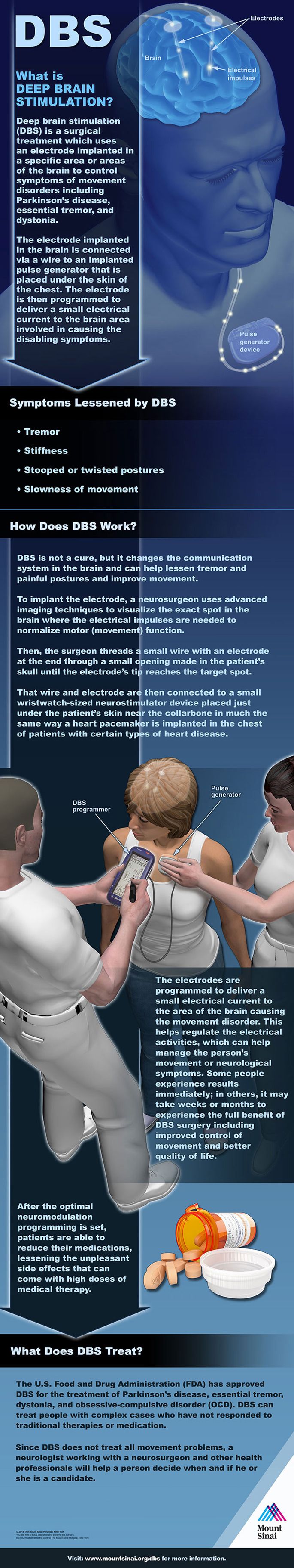 Deep Brain Stimulation Infographic