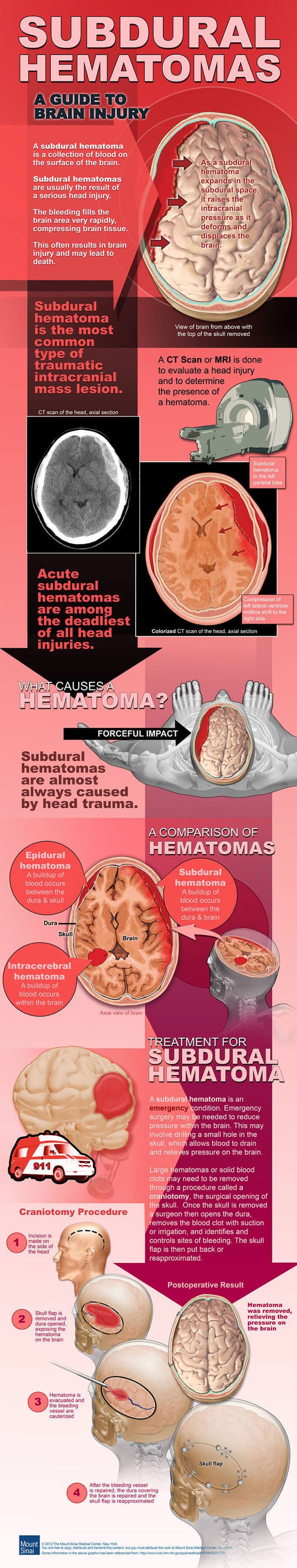 Neurotrauma Info