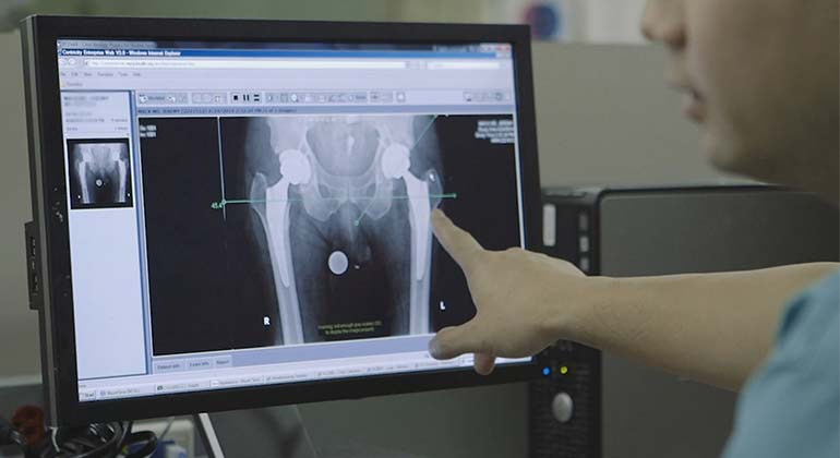Doctor examining hip x-rays
