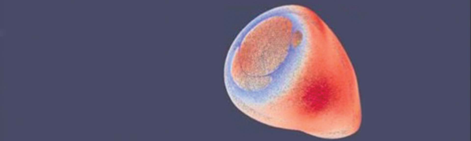 3D image of artery