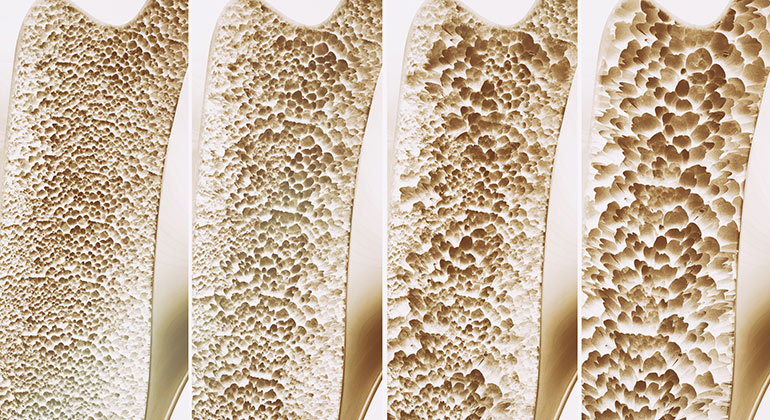 close up of bone interior