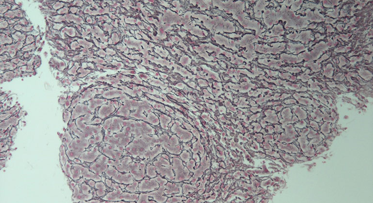 reticulin stain
