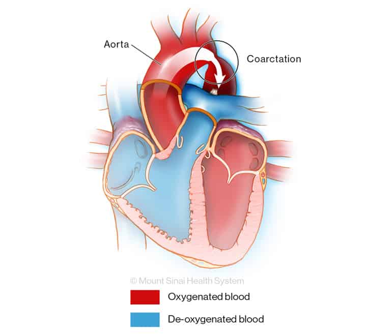 Aorta Diagram Of The Heart