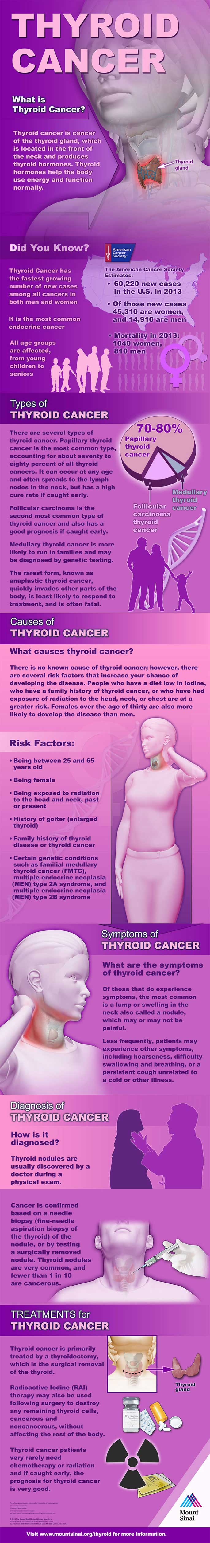 thyroid cancer