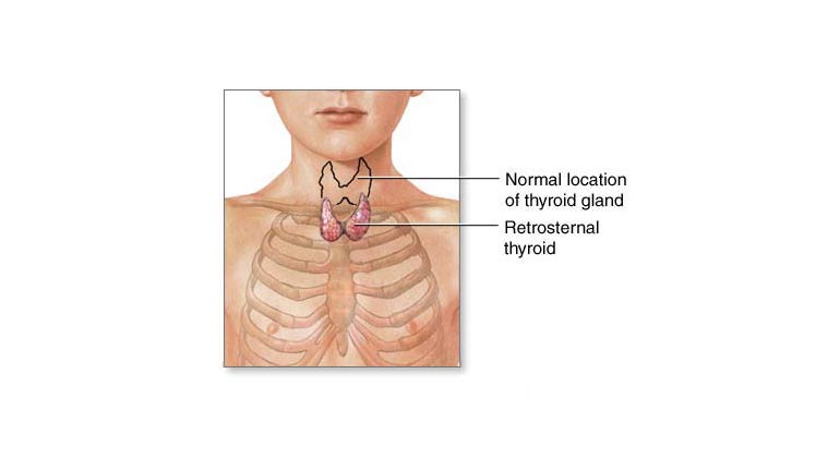 Thyroid location graphic
