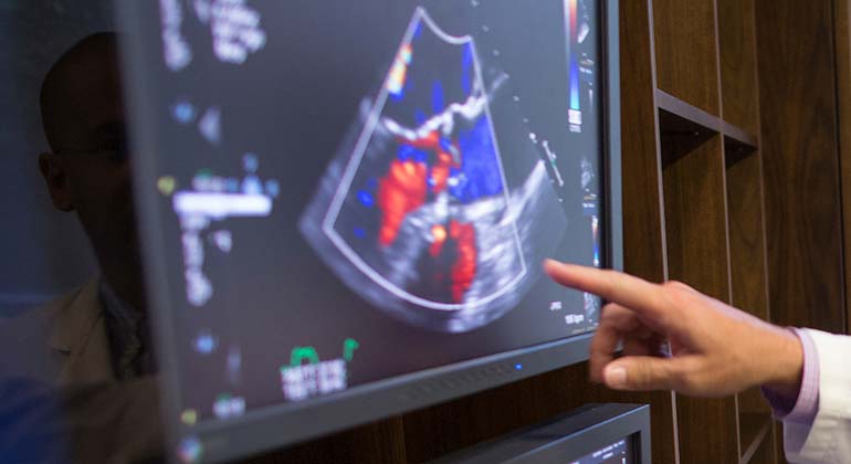 Doctor pointing to heart scan