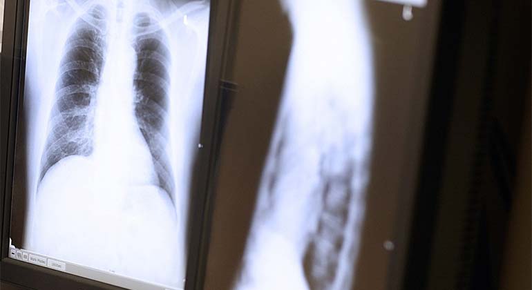 chest x rays