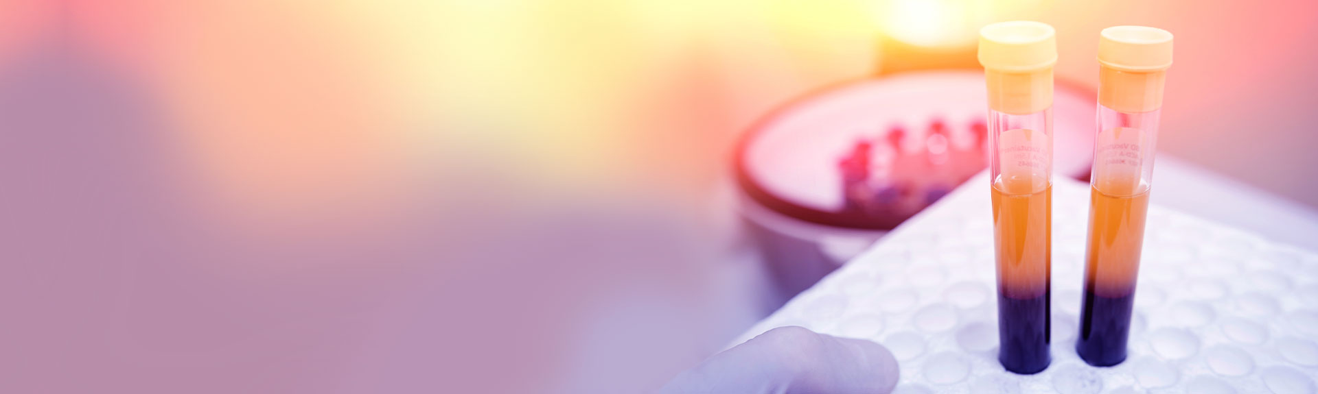 Image of blood tubes