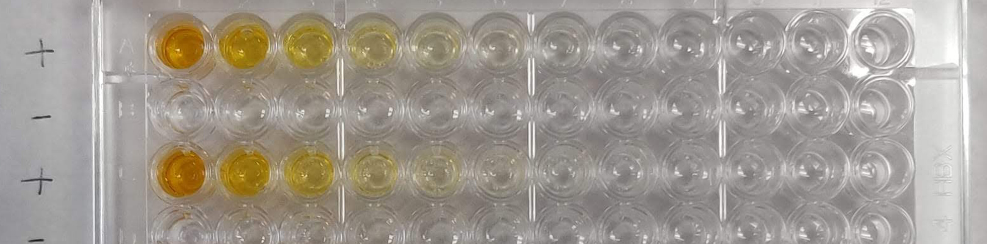 Image of antibody tests