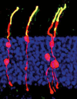 Macro view of retinal stem cells in process of division.