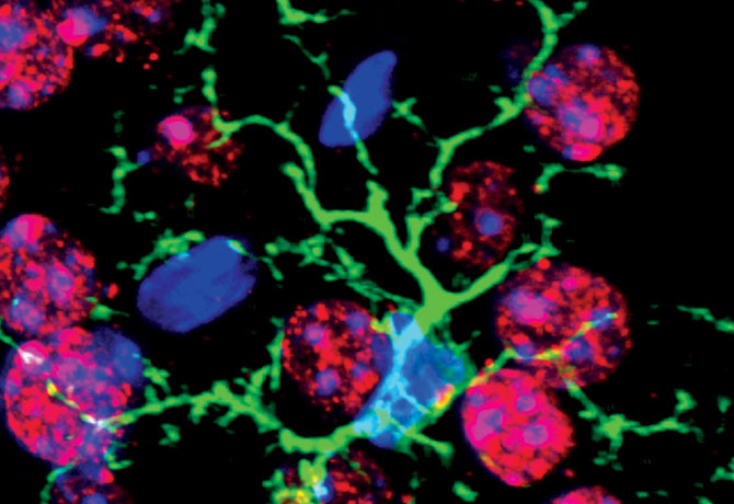 An image shows a striatal microglia (green) that is surrounded by histone H3 lysine 3 trimethylation positive (red) medium spiny neurons. Nuclei are shown by DAPI (blue). Credit: Pinar Ayata, PhD, Postdoctoral Fellow, Schaefer Laboratory