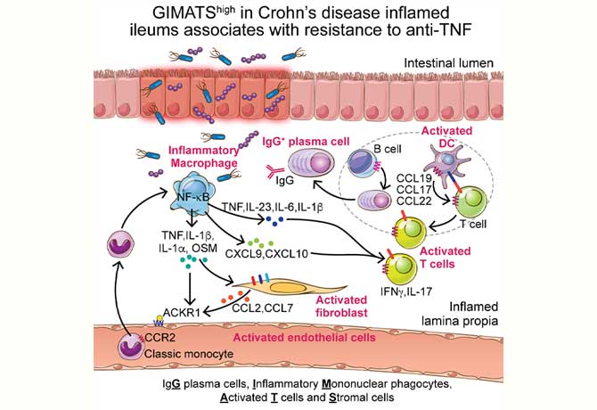 An illustration titled GIMATShigh in Crohn’s disease inflamed ileums associates with resistance to anti-TNF