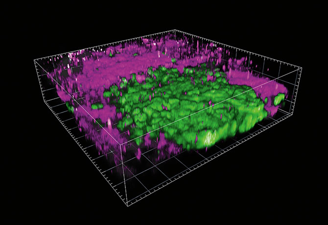 In vivo imaging of lymph node metastasis from a melanoma tumor