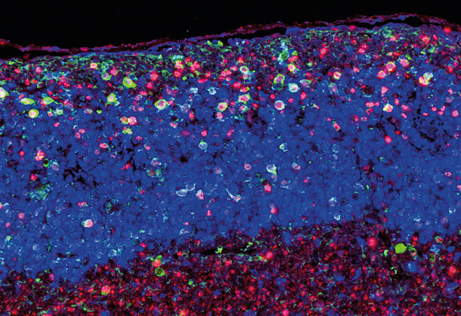 Image of a germinal center within a mouse lymph node