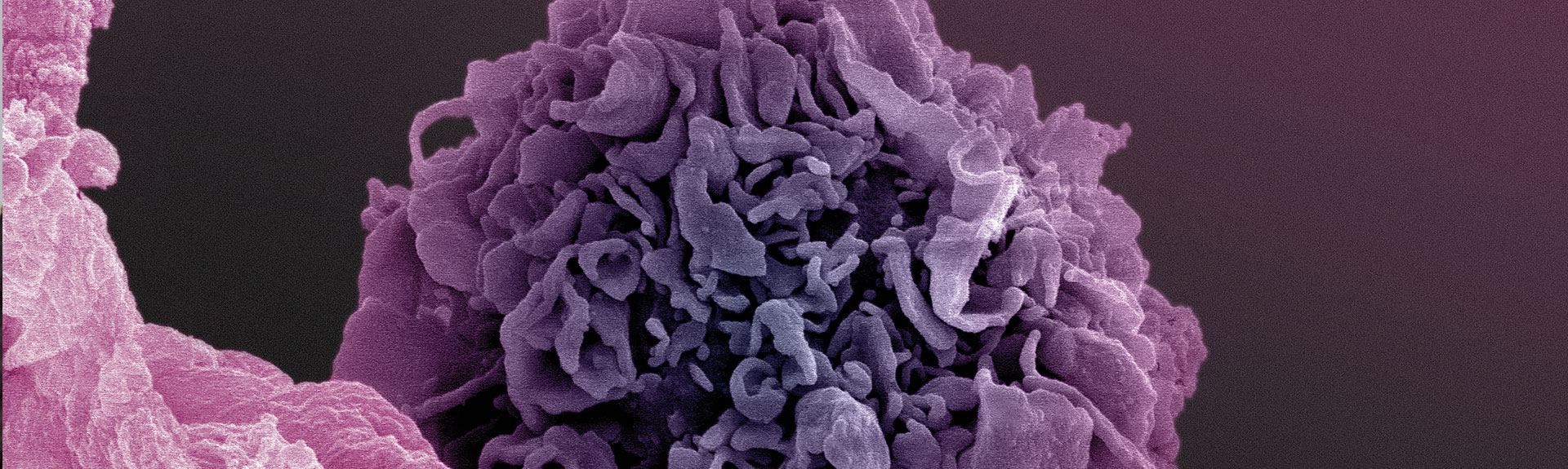 A photo showing human dendritic cells prepared in the Bhardwaj laboratory.  Andrew P. Leonard, photo