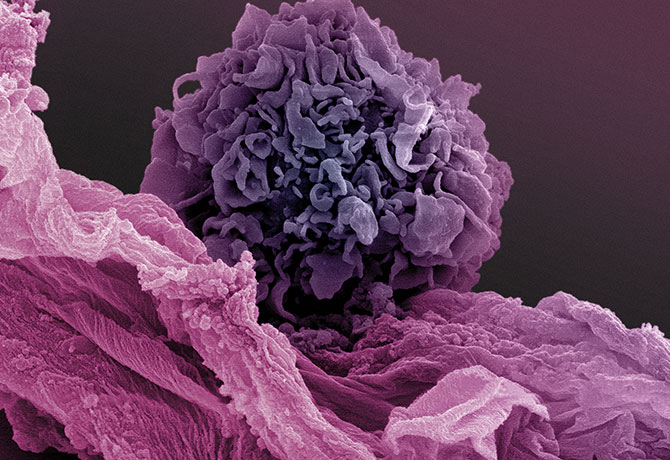 A photo showing human dendritic cells prepared in the Bhardwaj laboratory.  Andrew P. Leonard, photo