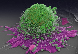 The Tisch Cancer Institute