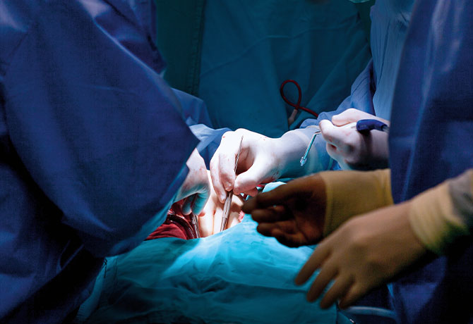 A photo showing a coronary artery bypass grafting procedure.