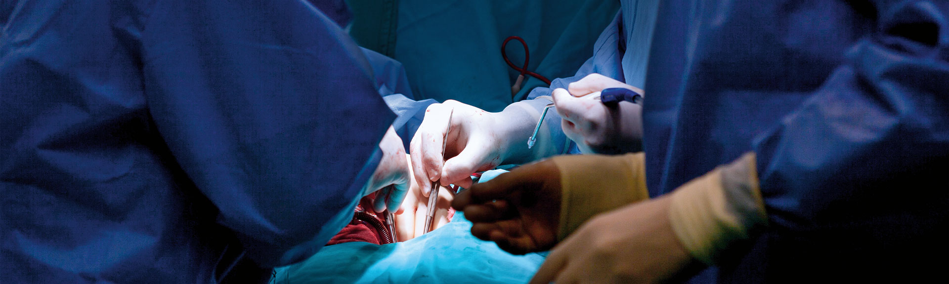 A photo showing a coronary artery bypass grafting procedure.