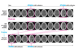 Neurology and Neurosurgery