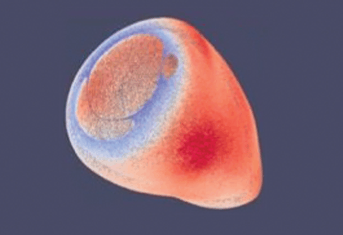 An image shows a computer model of the left ventricle in a newborn baby constructed from cardiac magnetic resonance imaging.