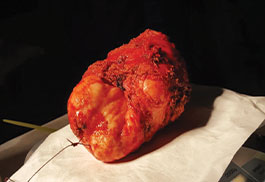 Urology