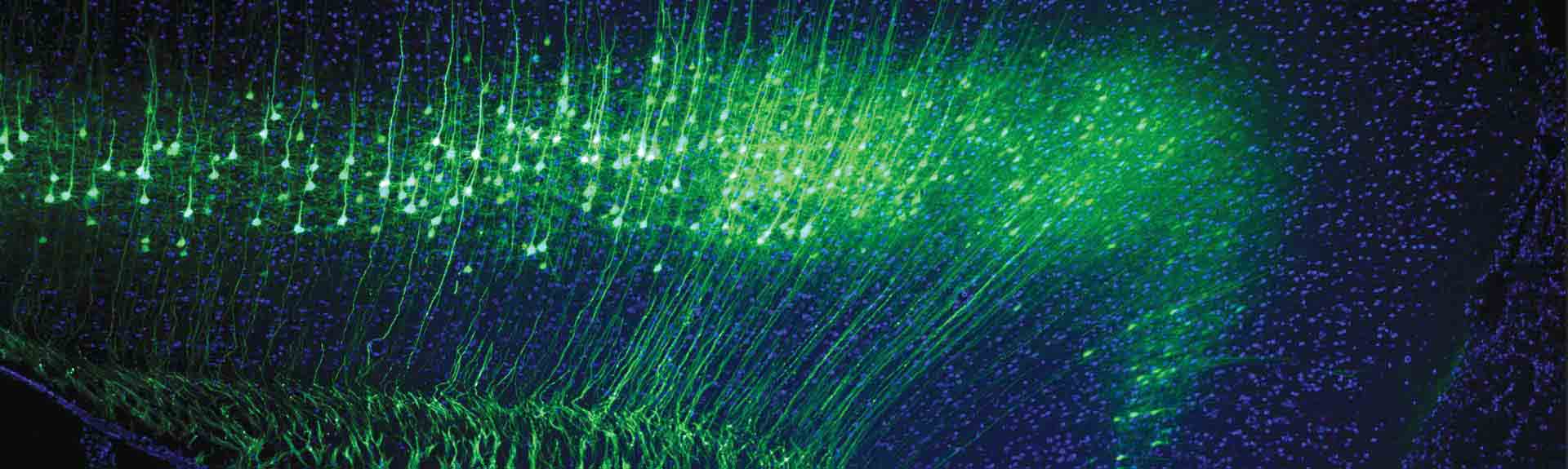An image showing fluorescent labeling of neurons in the mouse brain. Viral-mediated retrograde labeling of corticopontine excitatory neurons in the mouse motor cortex is used to understand the cellular underpinnings of DDX3X syndrome, a rare genetic disorder associated with intellectual disability and autism.