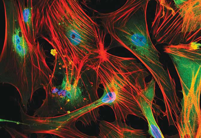 A photo showing human embryonic stem cells overexpressing Plexin-B2 and a mechanoregulator YAP (green) show aberrant morphologies and stress fibers (red). Nuclear staining (blue).