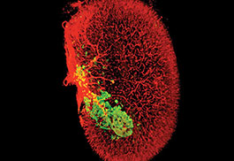 Endocrinology, Diabetes and Bone Disease