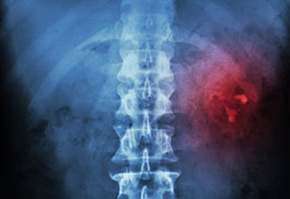 Urology