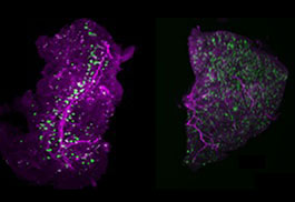 Endocrinology, Diabetes and Bone Disease