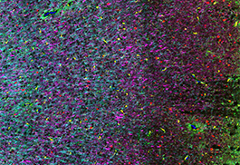 The Friedman Brain Institute