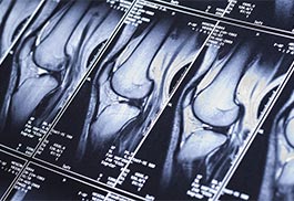 Orthopedics