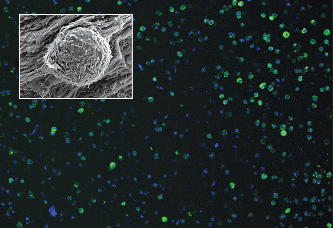 Image shows staining for cell viability of annulus fibrosus cells seeded in fibrin-genipin hydrogel sealant at 24 hours