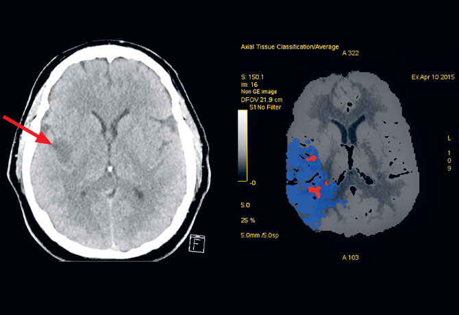 Image of CT head scan